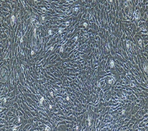羊肺微血管内皮细胞
