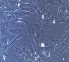 兔卵巢颗粒细胞