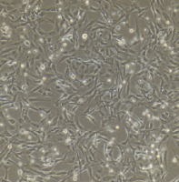 兔脐静脉内皮细胞