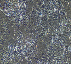 兔髓核细胞