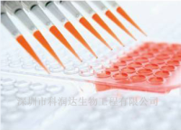 乙脑病毒IgG试剂盒