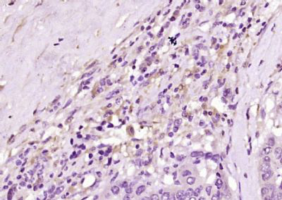 转甲状腺素蛋白/前白蛋白抗体