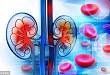 不明原因慢性肾脏病概述