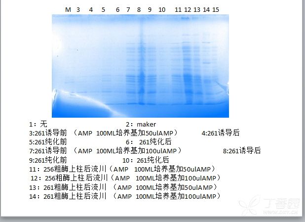 sds-page电泳图 蛋白质和糖学技术讨论版-丁香园论坛