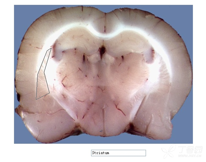 鼠脑纹状体图片