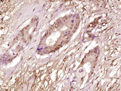 转录因子相关蛋白TRRAP抗体