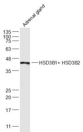 滋养层细胞抗原3β-HSD抗体
