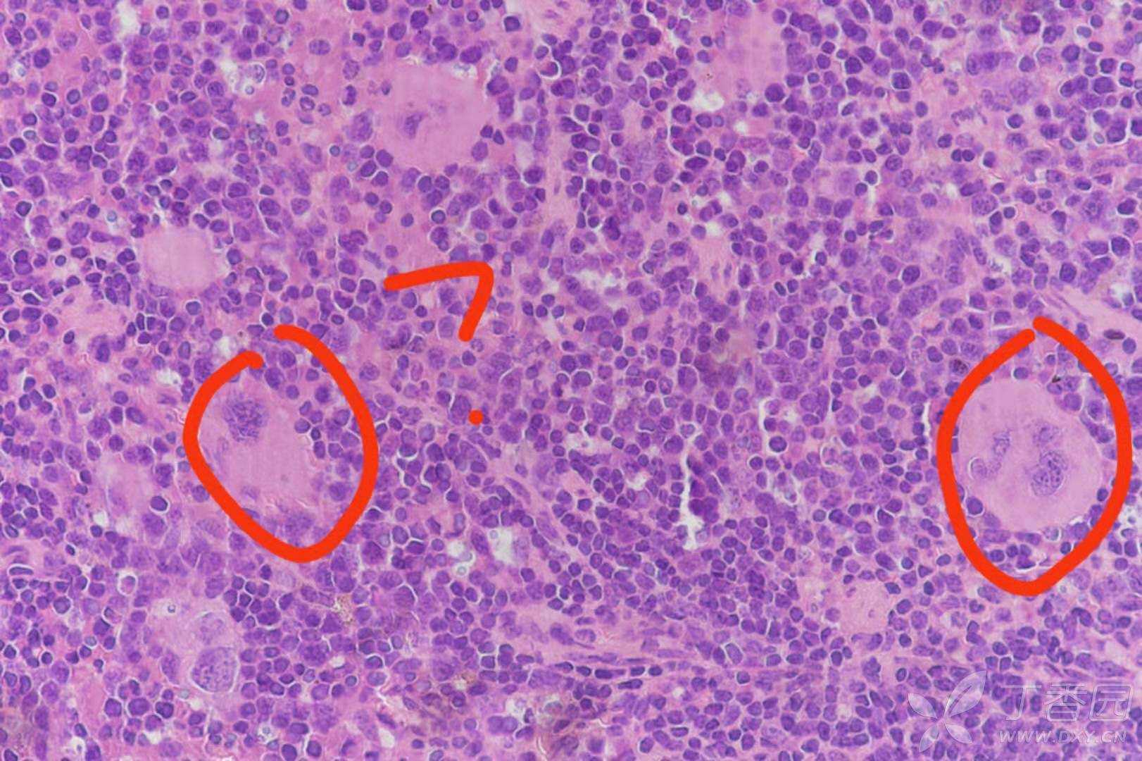 小鼠脾脏切片，HE染色，区分脾小体及其他 - 丁香园论坛
