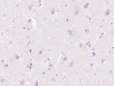胆固醇25羟化酶抗体