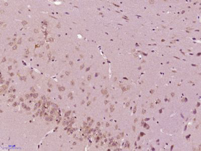 蛋氨酸亚砜还原酶MSRA抗体