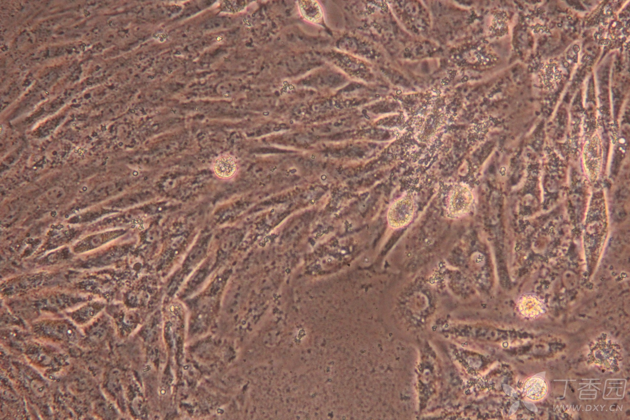 培养瓶底部出现很多黏在瓶底的渣渣,细胞状态奇差