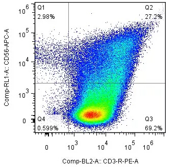 CIK细胞扩增试剂盒案例2