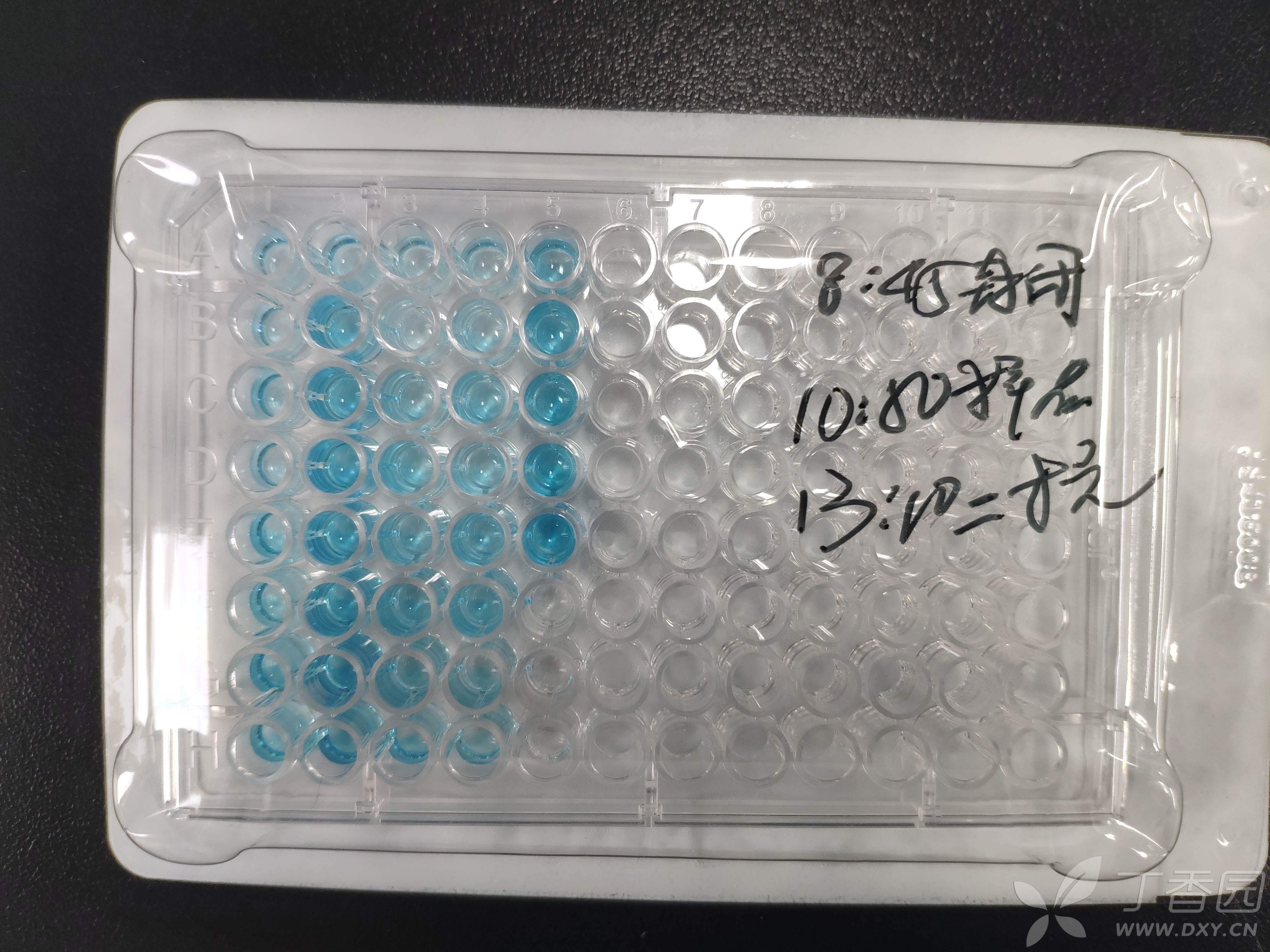 elisa空白组和标准品组od值一样 免疫学讨论版 专业医生社区,医学