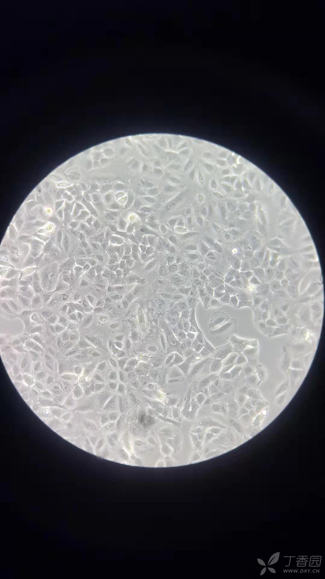 这个a549有问题吗,大神帮我看看 - 细胞技术讨论版 -丁香园论坛