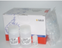 大片段DNA凝胶回收试剂盒