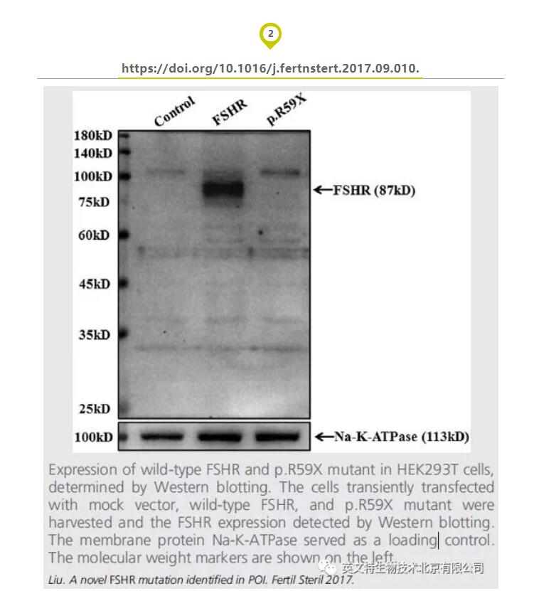 【收藏】细胞器蛋白定位，你需要这些 Marker！