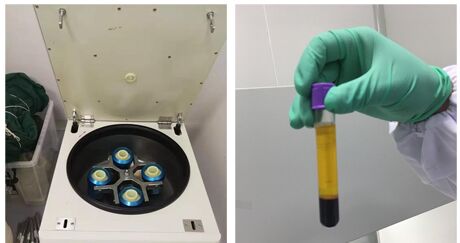 GM6001 (galardin, ilomastat)