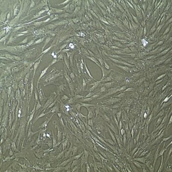 人间充质干细胞