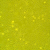 脐静脉内皮细胞，二代 Human Umbilical Vein Endothelial Cells (HUVEC)，P2