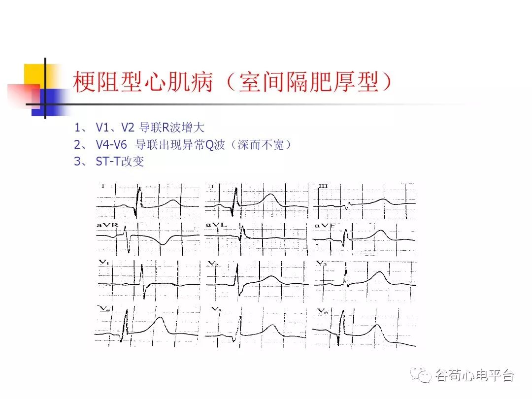 丁香园最新文章