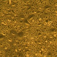 人角膜上皮细胞