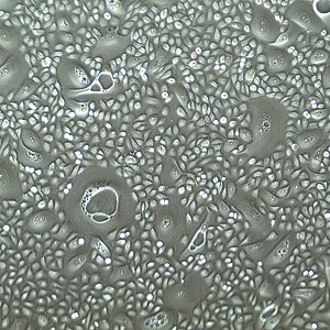 人膀胱上皮细胞-顶点