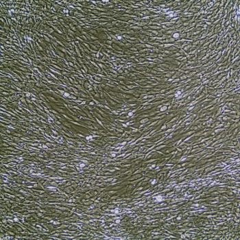 人巩膜成纤维细胞 Human Scleral Fibroblasts