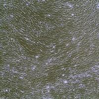 人巩膜成纤维细胞 Human Scleral Fibroblasts