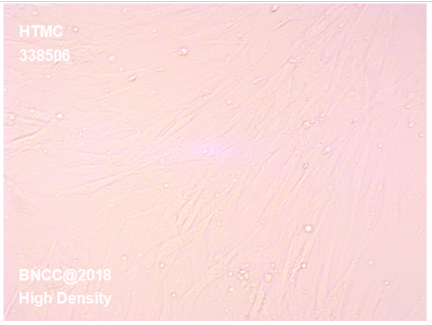 人眼小梁网细胞