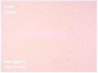 人眼小梁网细胞