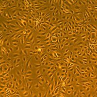 人髂动脉内皮细胞