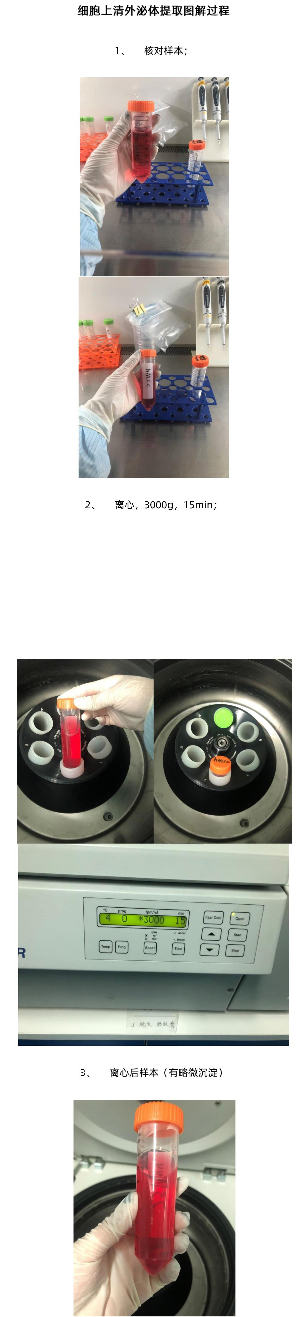 细胞上清外泌体提取图解过程