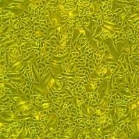 人小气道上皮细胞-原代Normal Human Small Airway Epithelial Cells, Primary