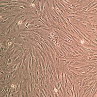 人骨髓间充质干细胞