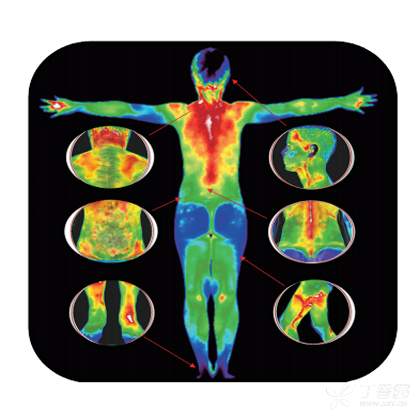 安全,无创,无辐射 tmt医用红外热像仪被动接受人体的自动热辐射而