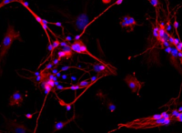 大鼠海马神经元