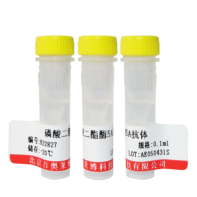 兔抗前列腺特异性抗原(PSA)抗体北京供应商