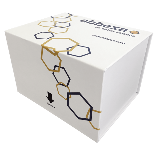 Abbexa/17-Hydroxyprogesterone (17-OHP) ELISA Kit/abx150306/abx150306-10 × 96 tests