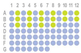 [生存期膀胱癌，79点]HBlaU079Su01 添加CD8、PDL1数据
