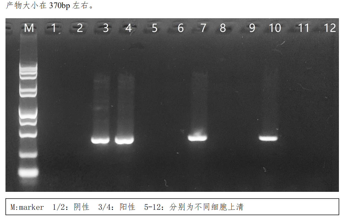 聊聊支原体污染这个事儿