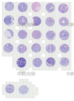 睾丸癌组织芯片 M261701
