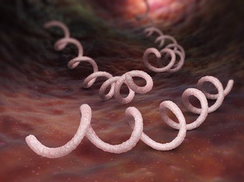 NEJM:神经梅毒Neurosyphilis(临床表现)