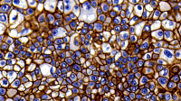 免疫组化（IHC）实验