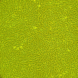 人皮肤成纤维细胞-新生儿Human Dermal Fibroblasts – Neonatal, Primary