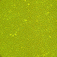 人皮肤成纤维细胞-新生儿Human Dermal Fibroblasts – Neonatal, Primary
