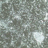 输卵管上皮细胞Fallopian Tube Epithelial Cell