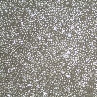 人宫颈上皮细胞Human Cervical Epithelial Cells