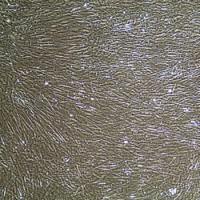 人前列腺平滑肌细胞Prostate Smooth Muscle Cells