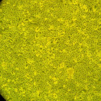 人膀胱上皮细胞-穹顶Human Bladder Dome Epithelial Cells — Primary