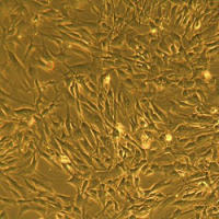 人肺动脉平滑肌细胞Normal Human Pulmonary Artery Smooth Muscle Cells